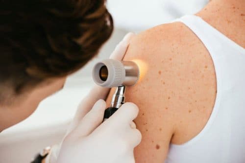 Hautkrebsvorsorge/Screening